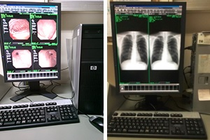 PACS装置（モニター画像診断）